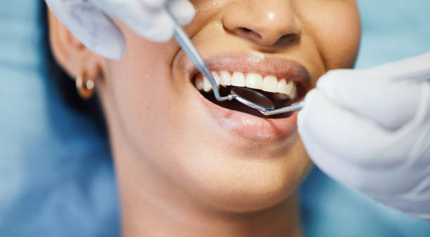 Best Emergency Dental Extractions in Green River, WY