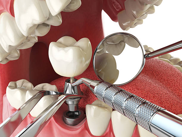 Best Mobile Emergency Dentist in Green River, WY