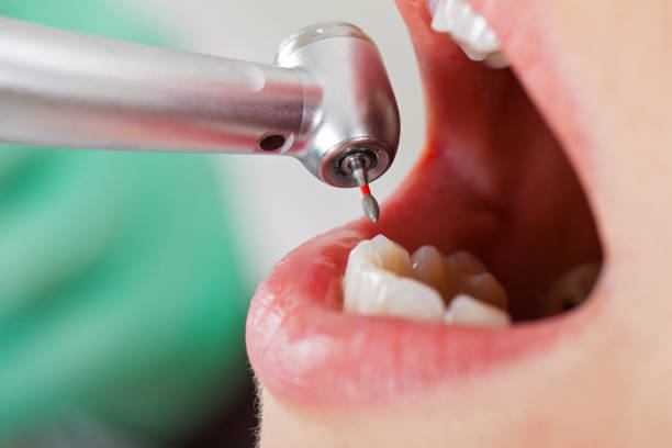 , WY Emergency Dentist Company